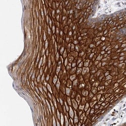 C4.4A/LYPD3 Antibody, Novus Biologicals 25 &mu;L, Unlabeled:Antibodies,