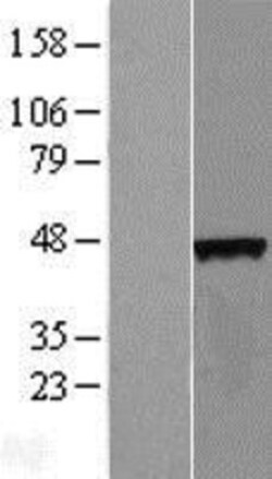 Novus Biologicals&trade;&nbsp;C4orf17 Overexpression Lysate