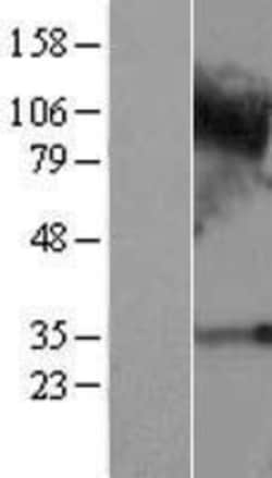 Novus Biologicals&trade;&nbsp;C4orf19 Overexpression Lysate