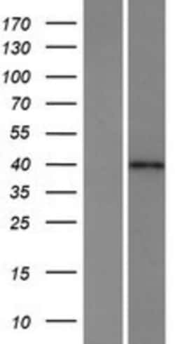 Novus Biologicals™ HPF1 Overexpression Lysate