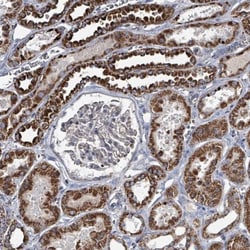 ABHD18 Antibody, Novus Biologicals:Antibodies:Primary Antibodies