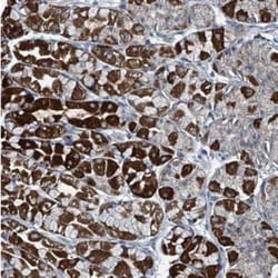 ABHD18 Antibody, Novus Biologicals:Antibodies:Primary Antibodies