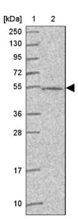 ABHD18 Antibody, Novus Biologicals:Antibodies:Primary Antibodies