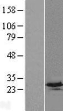 Novus Biologicals™ C4orf33 Overexpression Lysate