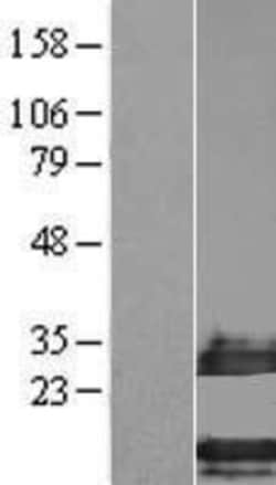 Novus Biologicals™ SMIM14 Overexpression Lysate