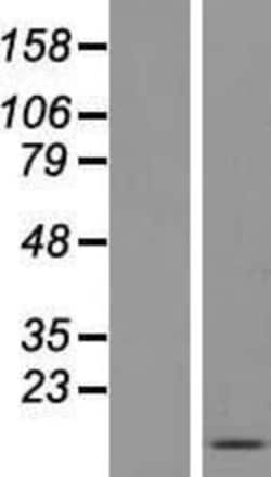 Novus Biologicals™ FDCSP Overexpression Lysate