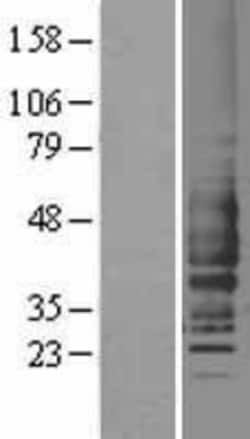 Novus Biologicals&trade;&nbsp;Complement Component C5aR1 Overexpression Lysate