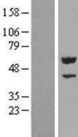 Novus Biologicals&trade;&nbsp;C5orf22 Overexpression Lysate