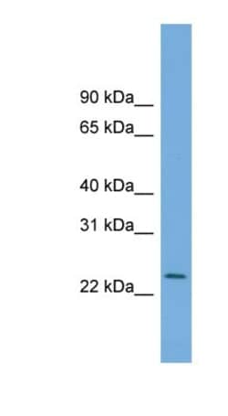 C5orf24 Antibody, Novus Biologicals 100&mu;L; Unlabeled:Antibodies, Polyclonal
