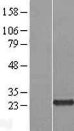 Novus Biologicals&trade;&nbsp;C5orf24 Overexpression Lysate