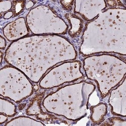 C5orf30 Antibody, Novus Biologicals:Antibodies:Primary Antibodies