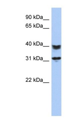 SETD9 Antibody, Novus Biologicals 100&mu;L; Unlabeled:Antibodies, Polyclonal