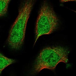 CPLANE1 Antibody, Novus Biologicals 25 &mu;L | Buy Online | Novus Biologicals | Fisher Scientific