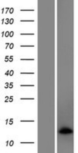 Novus Biologicals&trade;&nbsp;EXOC3-AS1 Overexpression Lysate