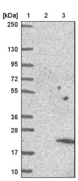 SMIM29 Antibody, Novus Biologicals 0.1mL; Unlabeled:Antibodies, Polyclonal