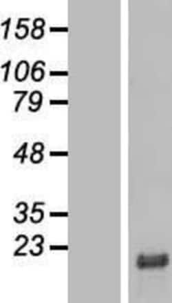 Novus Biologicals™ SMIM29 Overexpression Lysate