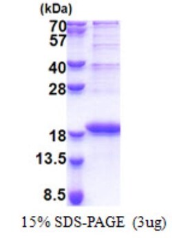Novus Biologicals&trade;&nbsp;Recombinant Human SMIM29 His Protein