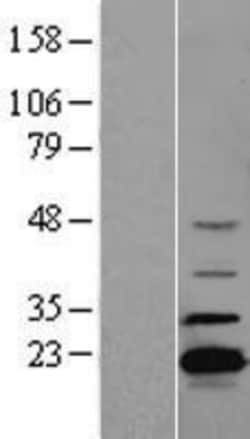 Novus Biologicals&trade;&nbsp;ADTRP Overexpression Lysate