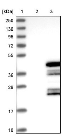 C6orf106 Antibody, Novus Biologicals 0.1mL; Unlabeled:Antibodies, Polyclonal