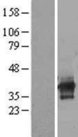 Novus Biologicals&trade;&nbsp;C6orf106 Overexpression Lysate