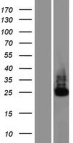 Novus Biologicals&trade;&nbsp;C6orf106 Overexpression Lysate