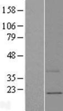 Novus Biologicals™ MNF1 Overexpression Lysate