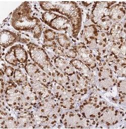 C6orf141 Antibody, Novus Biologicals:Antibodies:Primary Antibodies