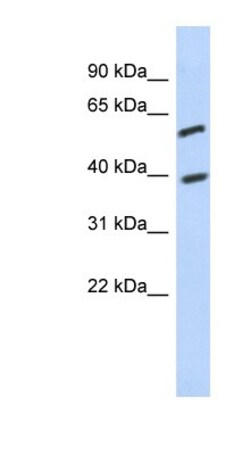 FAM217A Antibody, Novus Biologicals 100&mu;L; Unlabeled:Antibodies, Polyclonal