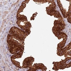 LRRC73 Antibody, Novus Biologicals:Antibodies:Primary Antibodies
