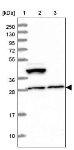 LRRC73 Antibody, Novus Biologicals:Antibodies:Primary Antibodies