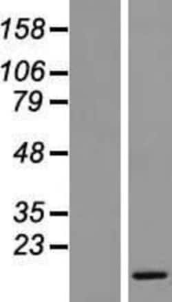 Novus Biologicals&trade;&nbsp;SMIM8 Overexpression Lysate