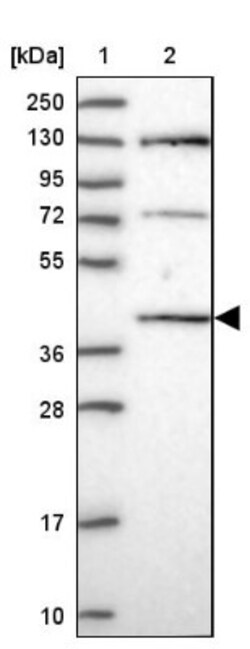 C6orf163 Antibody, Novus Biologicals 25 &mu;L | Buy Online | Novus Biologicals | Fisher Scientific