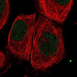 C6orf163 Antibody, Novus Biologicals 25 &mu;L | Buy Online | Novus Biologicals | Fisher Scientific