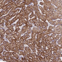 CFAP298 Antibody, Novus Biologicals 25 &mu;L | Buy Online | Novus Biologicals | Fisher Scientific