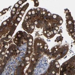 TBC1D32 Antibody, Novus Biologicals 0.1mL; Unlabeled:Antibodies, Polyclonal