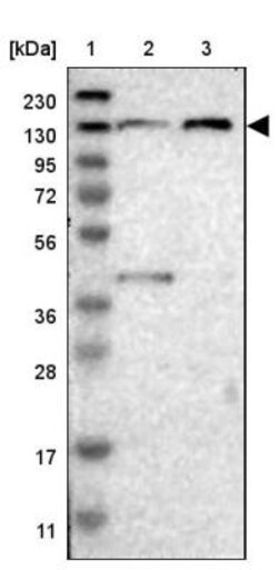 TBC1D32 Antibody, Novus Biologicals 0.1mL; Unlabeled:Antibodies, Polyclonal