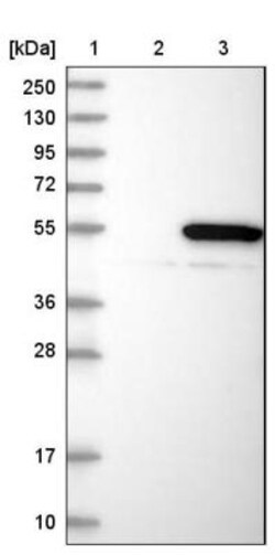ARMT1 Antibody, Novus Biologicals 0.1 mL | Buy Online | Novus Biologicals | Fisher Scientific