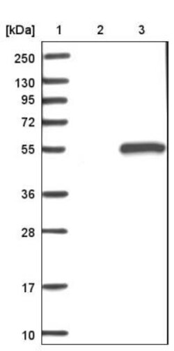 ARMT1 Antibody, Novus Biologicals 0.1mL; Unlabeled:Antibodies, Polyclonal