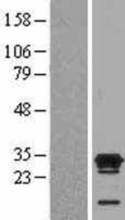 Novus Biologicals&trade;&nbsp;ECAT1 Overexpression Lysate