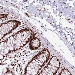 C6orf226 Antibody, Novus Biologicals 25 &mu;L; Unlabeled:Antibodies, Polyclonal