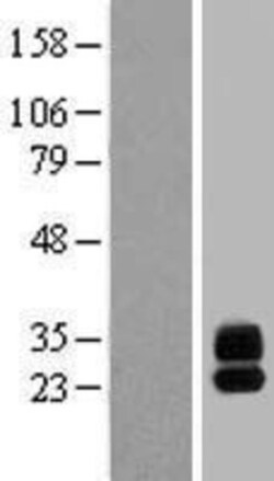 Novus Biologicals&trade;&nbsp;G6b/C6orf25 Overexpression Lysate