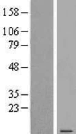 Novus Biologicals&trade;&nbsp;C6orf48 Overexpression Lysate