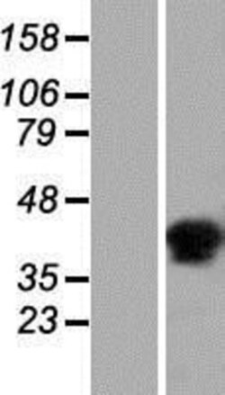 Novus Biologicals&trade;&nbsp;C6orf58 Overexpression Lysate