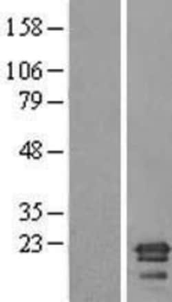 Novus Biologicals™ SAYSD1 Overexpression Lysate
