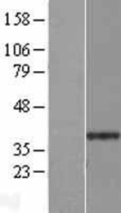Novus Biologicals™ GPALPP1 Overexpression Lysate