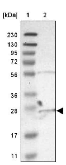 Bombesin Receptor Activated Protein Antibody, Novus Biologicals 0.1mL;