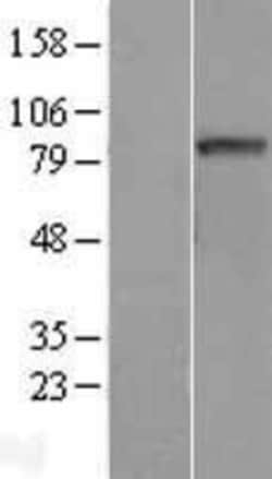 Novus Biologicals™ CCDC170 Overexpression Lysate