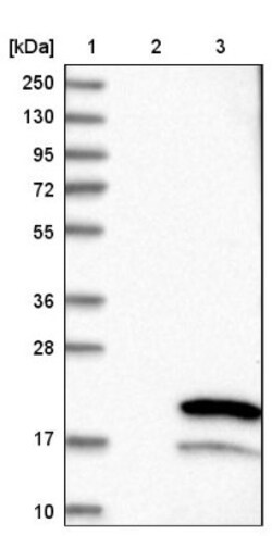 TMEM243 Antibody, Novus Biologicals 0.1mL; Unlabeled:Antibodies, Polyclonal