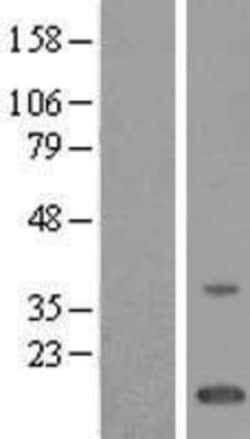Novus Biologicals&trade;&nbsp;TMEM243 Overexpression Lysate
