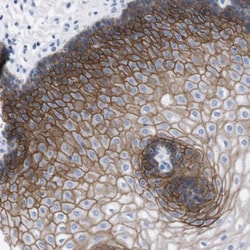 TMEM243 Antibody, Novus Biologicals 0.1mL; Unlabeled:Antibodies, Polyclonal